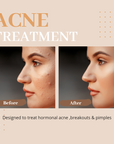 Clarifying Skin Supplement