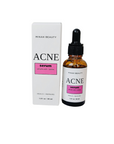 Acne Serum