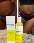 Stretch Mark Fading Oil