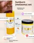 Melasma Set