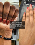 Knuckle Serum