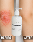 Eczema Calming Cream