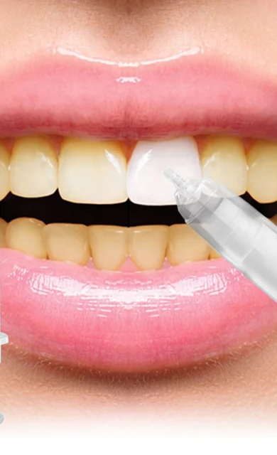 Teeth whitening gel pen