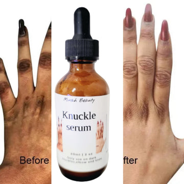 Knuckle serum (removes dark knuckles)