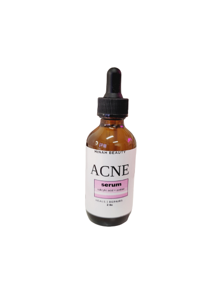 Acne and pimple serum