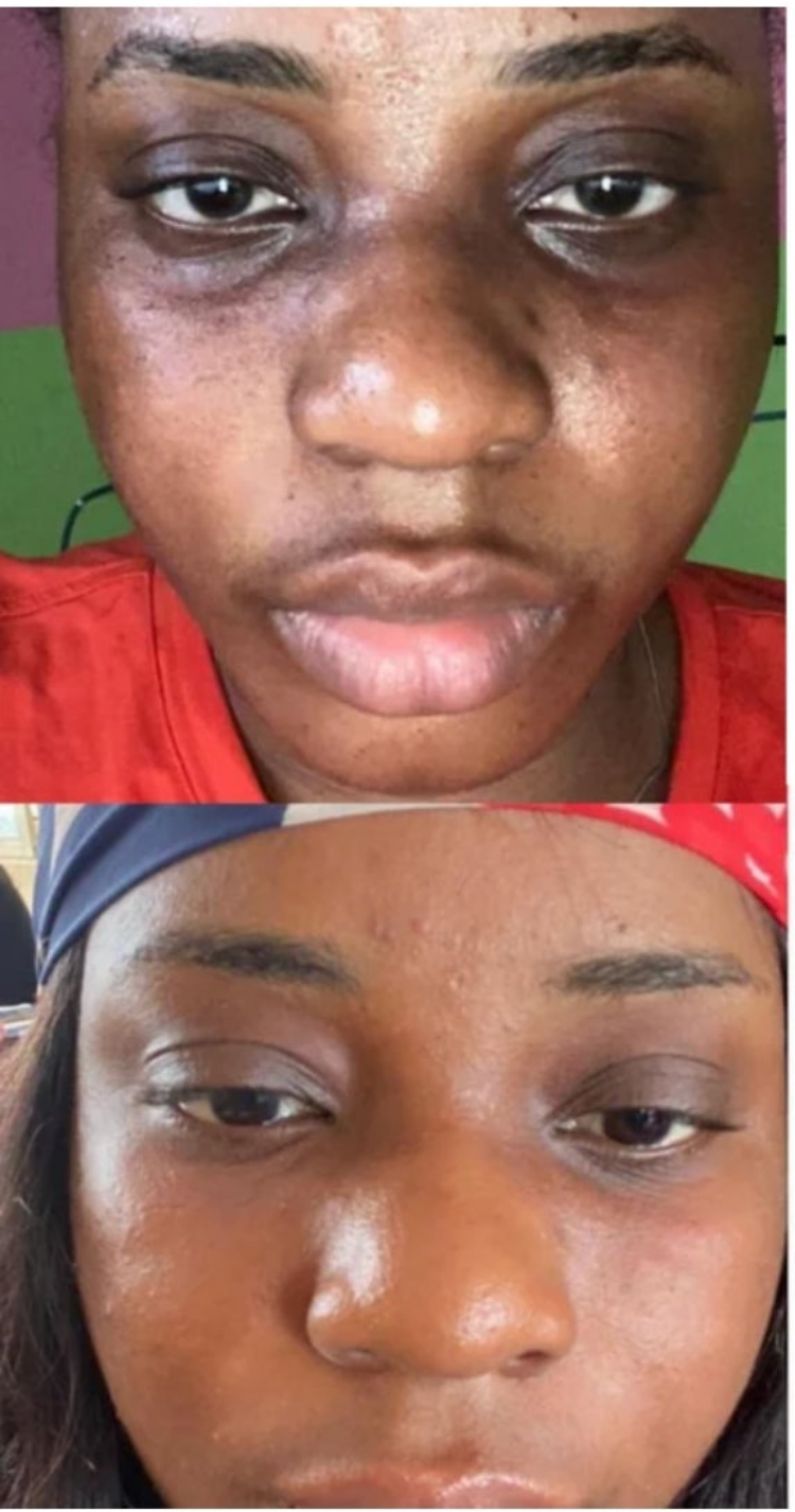 Dark Circle Eraser Eye Cream